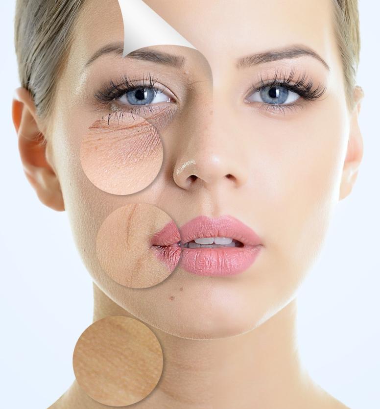 injectare acid hialuronic eptq